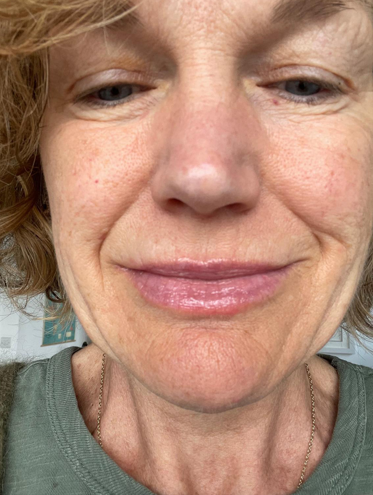 Lip Refreshment After Cut 1