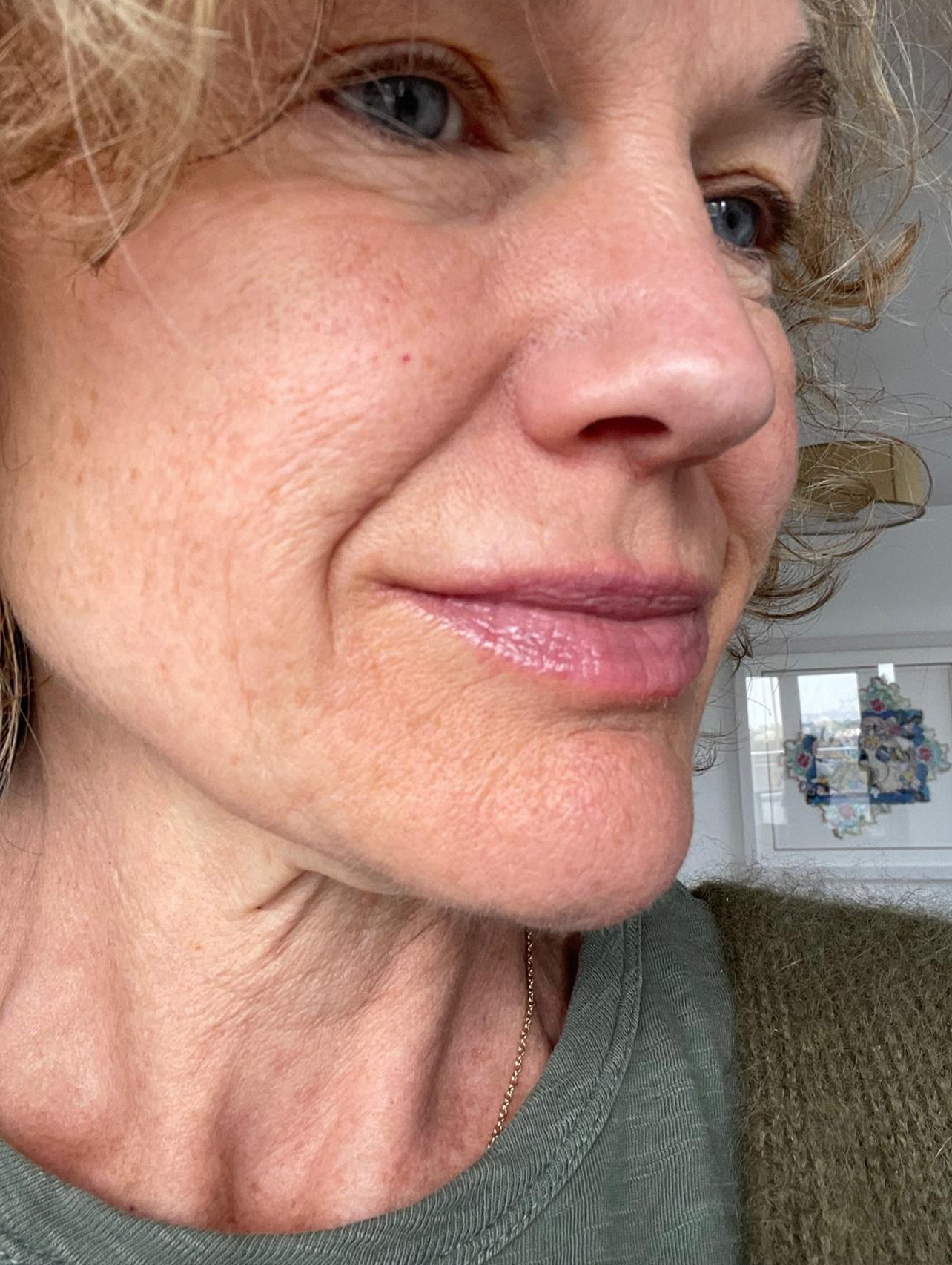 Lip Refreshment After 2 Cut